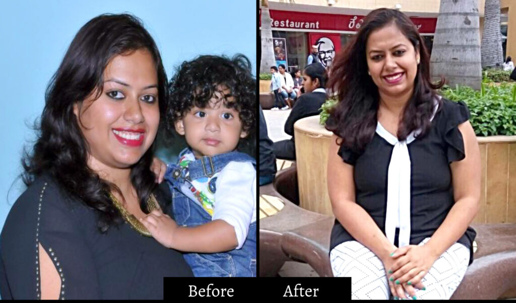 gunjan sharma before and after gunjan sharma before and after