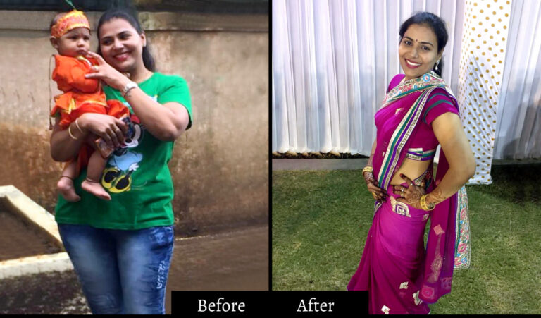 Nisha Shah Before and After Image