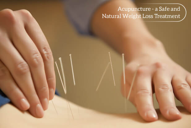 Acupuncture - a Safe and Natural Weight Loss Treatment Acupuncture - a Safe and Natural Weight Loss Treatment