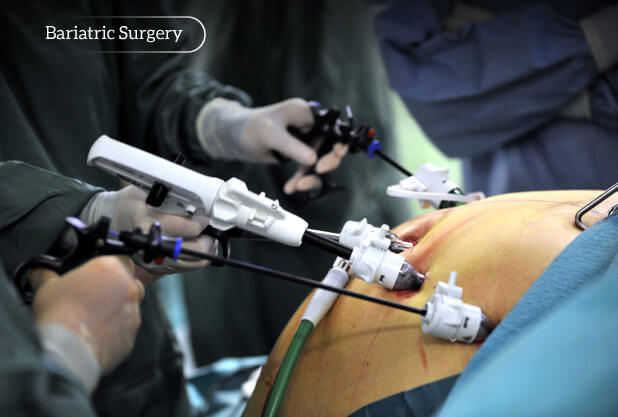 Bariatric surgery side effects Bariatric surgery side effects