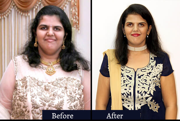 Niharika before & after weight loss Niharika before & after weight loss