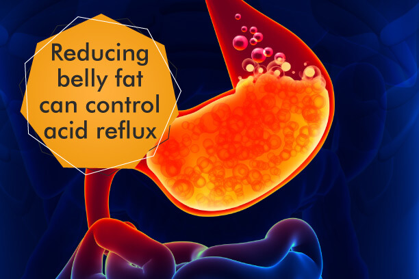 Shedding that belly fat can control acidity Shedding that belly fat can control acidity